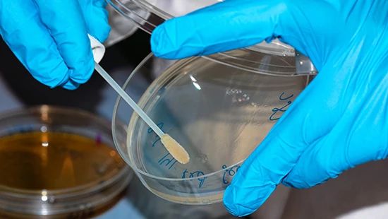 Micro-uitstrijkje_550x310 A gloved microbiologist swabs a sample onto a petri dish in the laboratory.